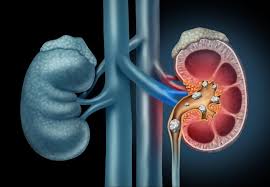 Urology Associates