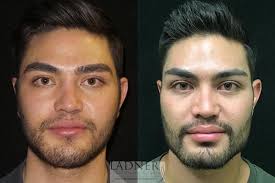 Islamabad Plastic Surgery and Skin Clinic