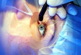 Z.E. EYE HOSPITAL