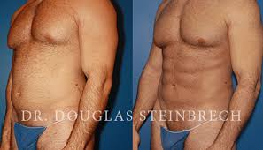 Dubai Cosmetic Surgery Dubai Cosmetic Surgery