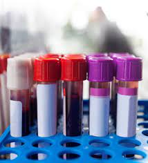 Agha Khan University Hospital Laboratory Collection Centre Agha Khan University Hospital Laboratory Collection Centre